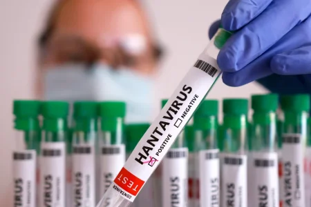 O‘zbekistonda xantavirus qayd etildimi? Epidemiologik vaziyatga aniqlik kiritildi